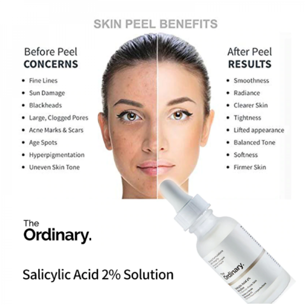 The Ordinary Niacinamide 10 + Zinc 1 30ml Skin Care The Ordinary Pakistan The Ordinary