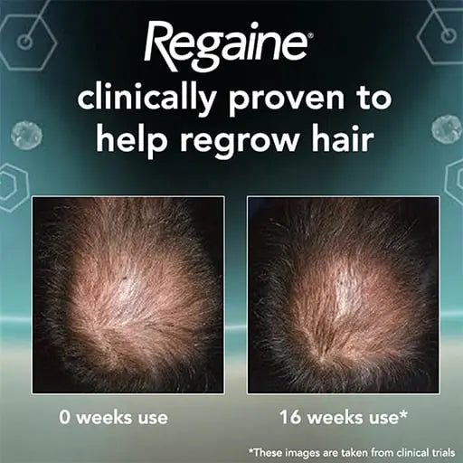 Regaine For Men Foam 3 Months (3-Months Supply 3*73ml)